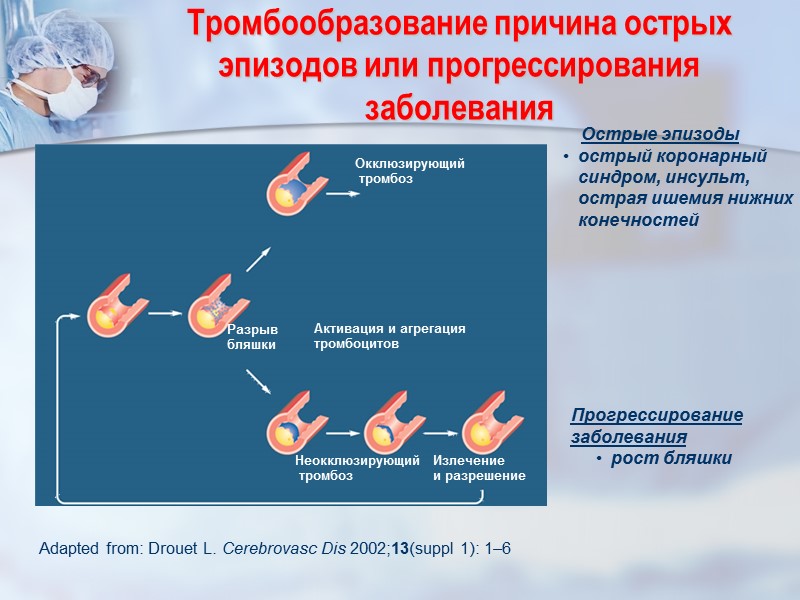 Разрыв бляшки Активация и агрегация тромбоцитов Неокклюзирующий  тромбоз Окклюзирующий  тромбоз Излечение 
